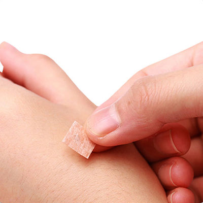 GB 2024-2016 Akupressurnadeln 0,2 mm x 1,5 mm für chinesische Medizin - Eigenschaften, Sicherheit