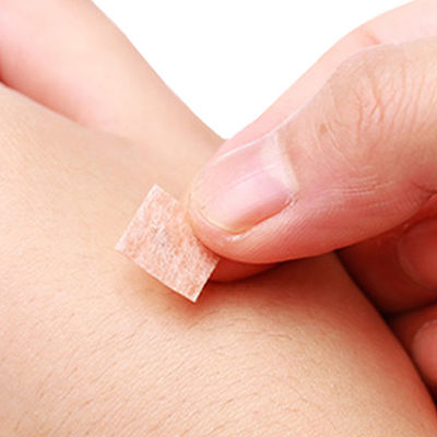 Scharfe Nadelspitze aus Edelstahl für Akupunkturpunkte für präzise Leistung